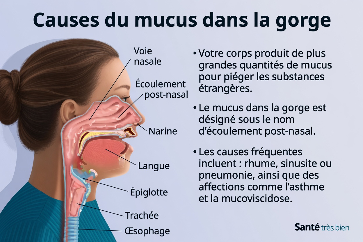 Pourquoi vous avez des glaires persistantes dans la gorge et quels facteurs du quotidien vous devriez connaître