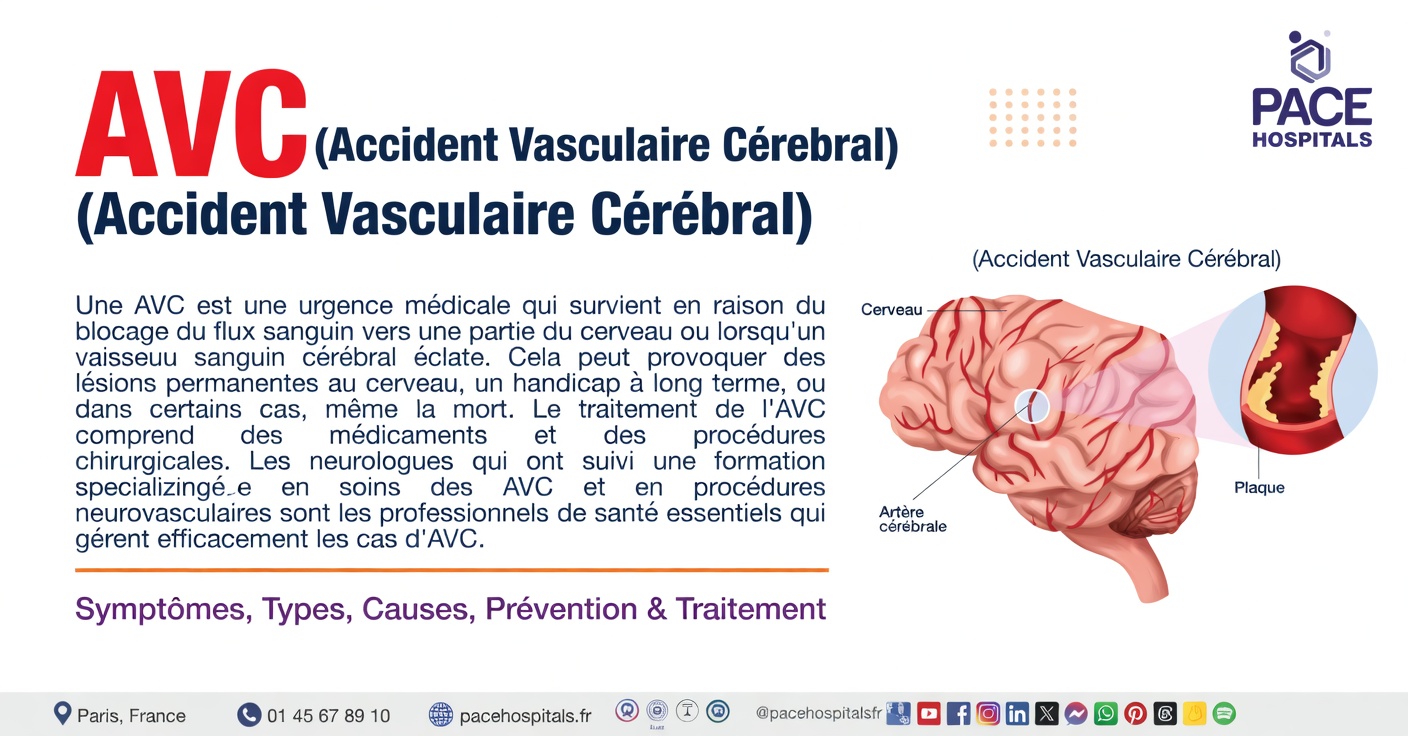 Ce symptôme du sommeil pourrait-il être un signe avant-coureur d’un AVC ?