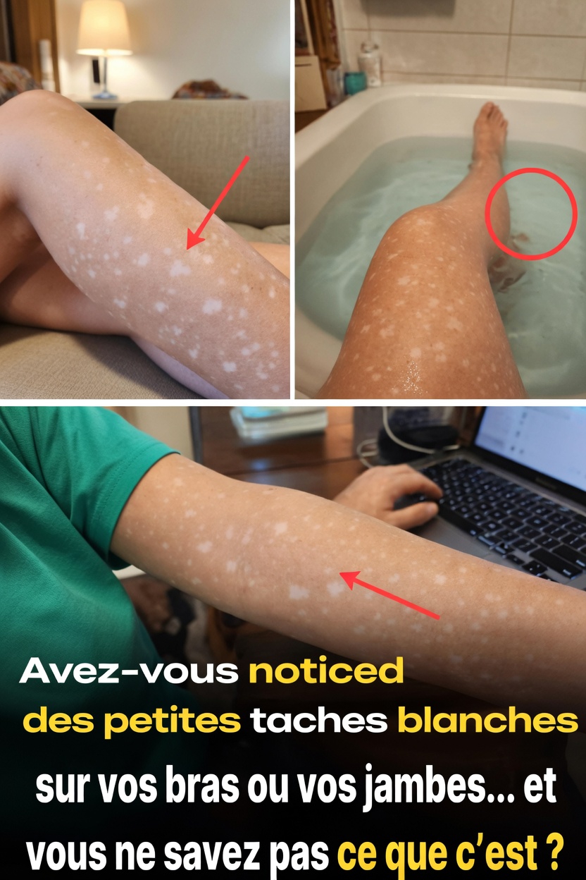 Pourquoi de petites taches blanches apparaissent-elles sur vos bras et vos jambes ? Comprendre les changements cutanés courants
