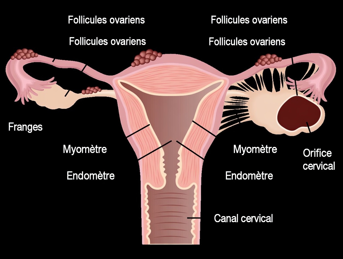 Alerte à l’endométriose : les habitudes quotidiennes à ne pas ignorer