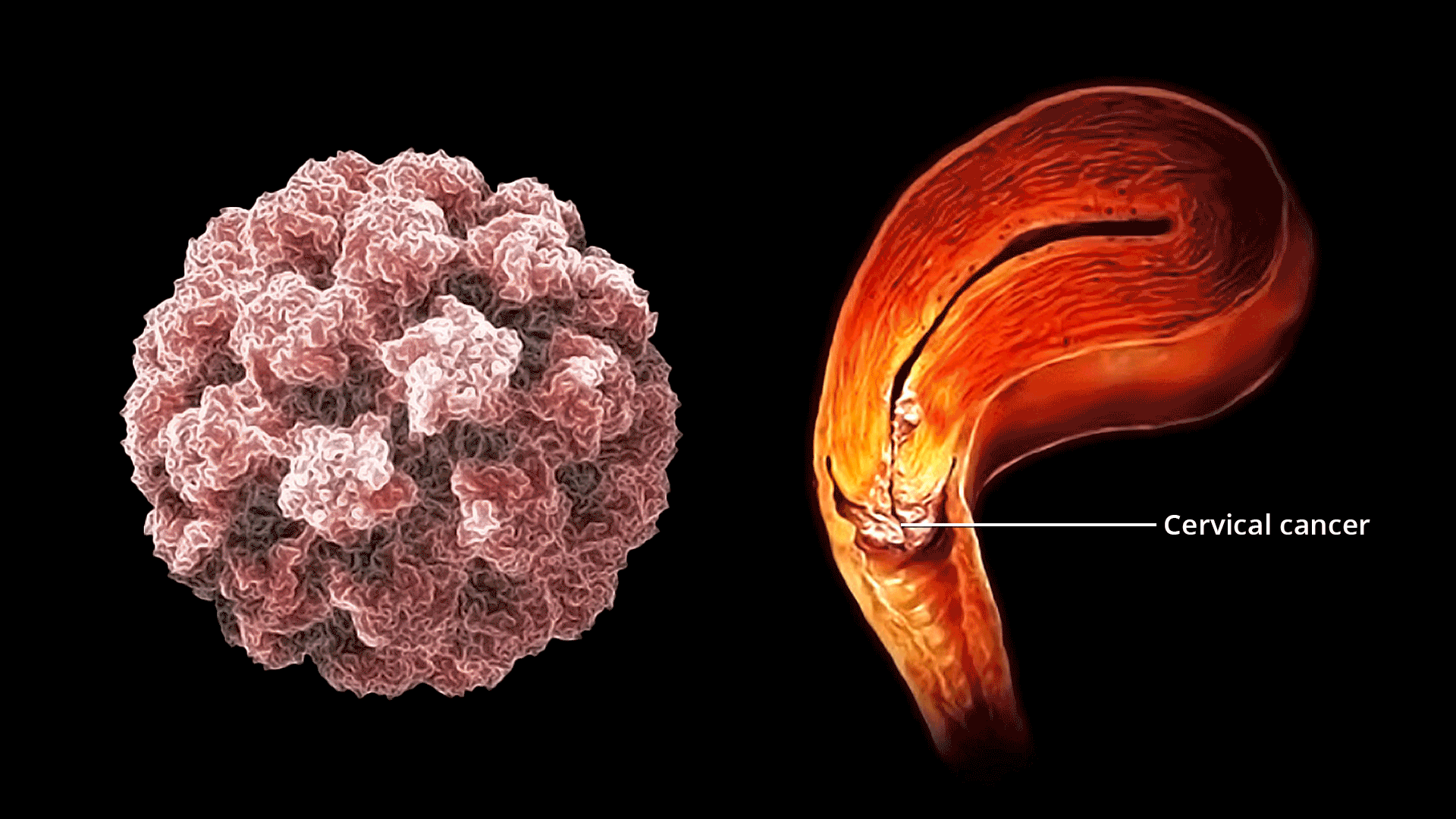 Les symptômes critiques du cancer du col de l’utérus que chaque femme doit connaître et ne jamais ignorer