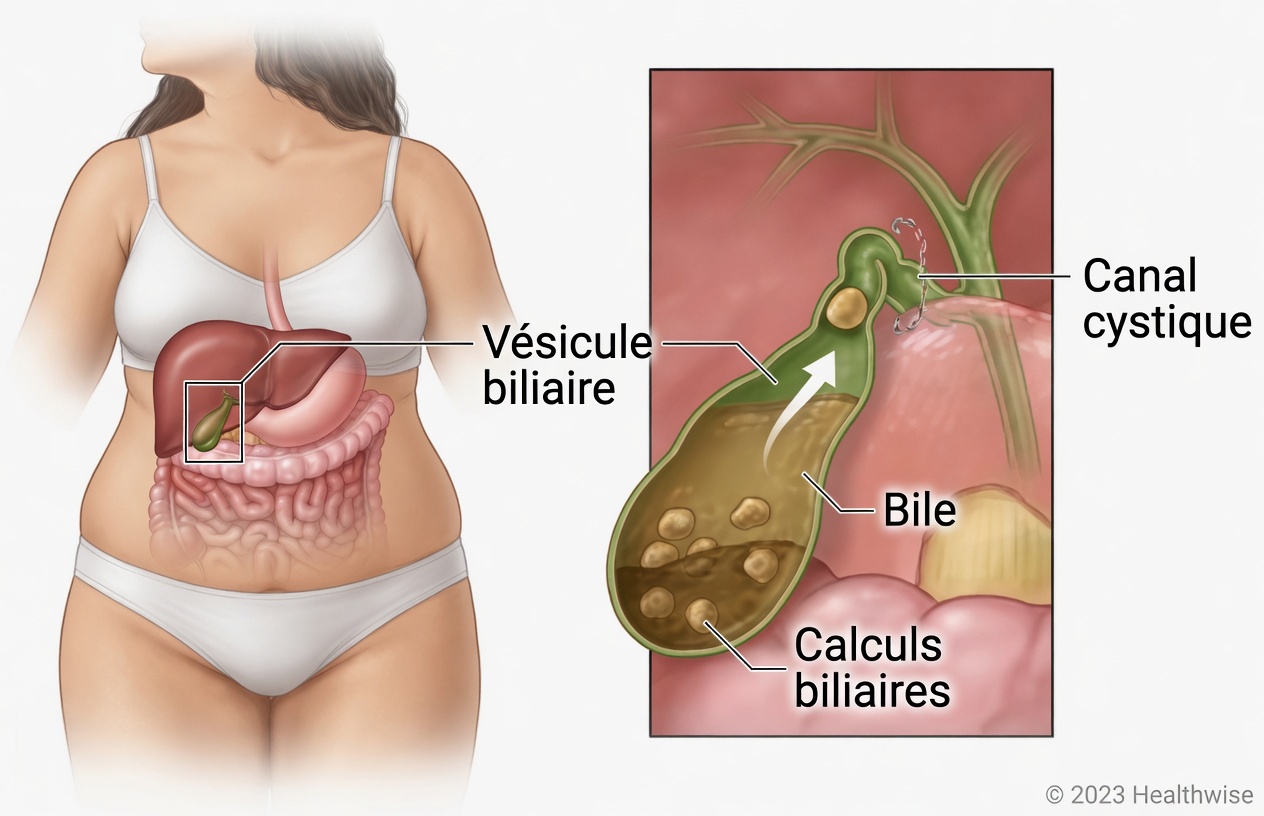 Découvrez deux habitudes quotidiennes qui peuvent favoriser le confort de la vésicule biliaire