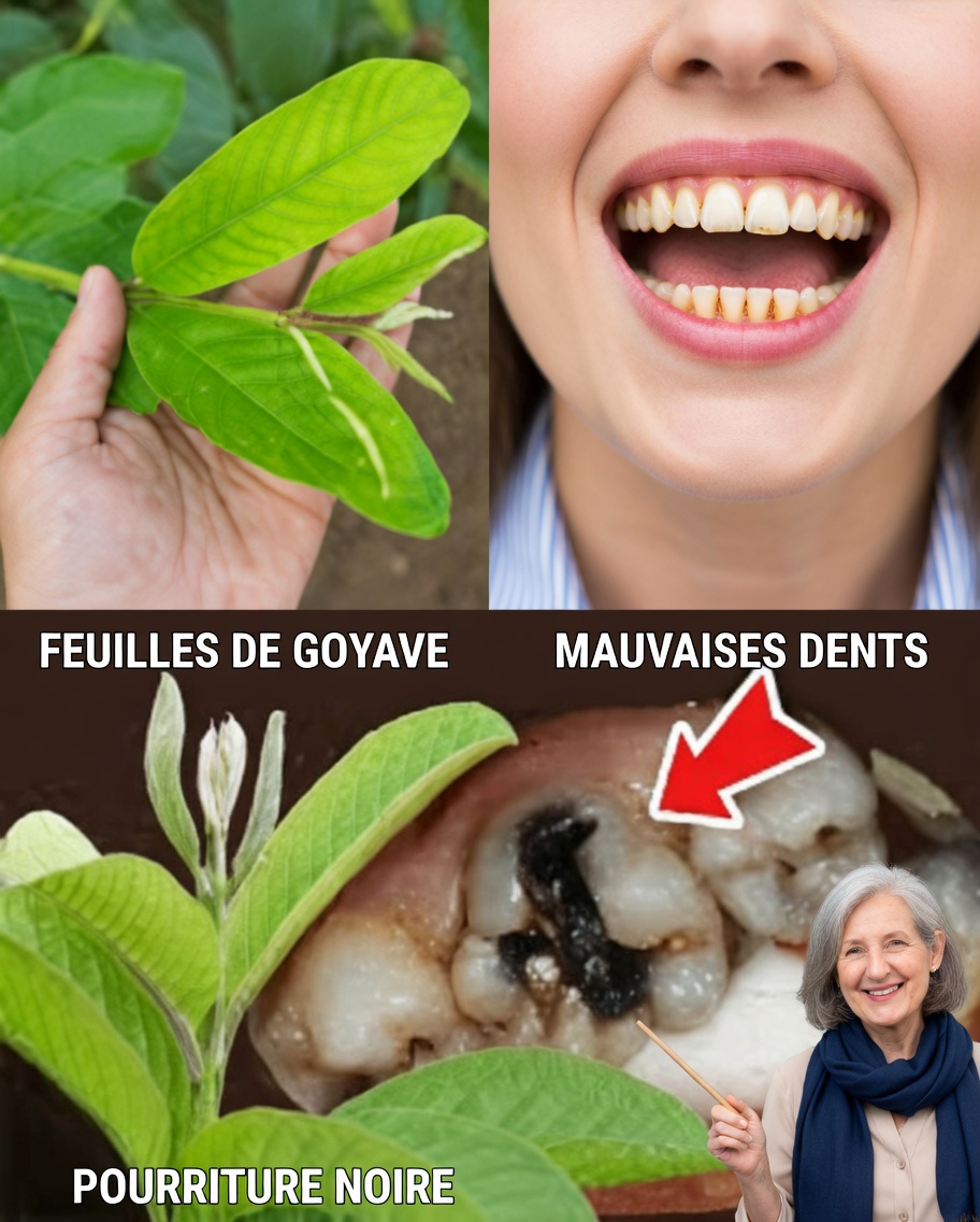 Les 3 meilleures façons de traiter la carie dentaire avec des feuilles de goyavier – simples et économiques