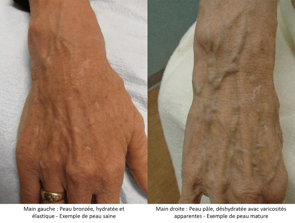 10 façons naturelles de se débarrasser des varices et d’améliorer naturellement la circulation sanguine