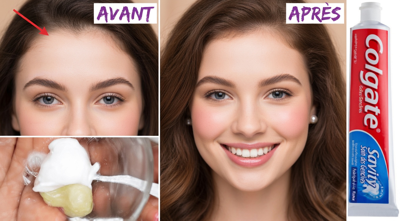 Laissez tomber le rasoir : à la découverte de l’astuce au dentifrice et à l’oignon pour une peau plus lisse