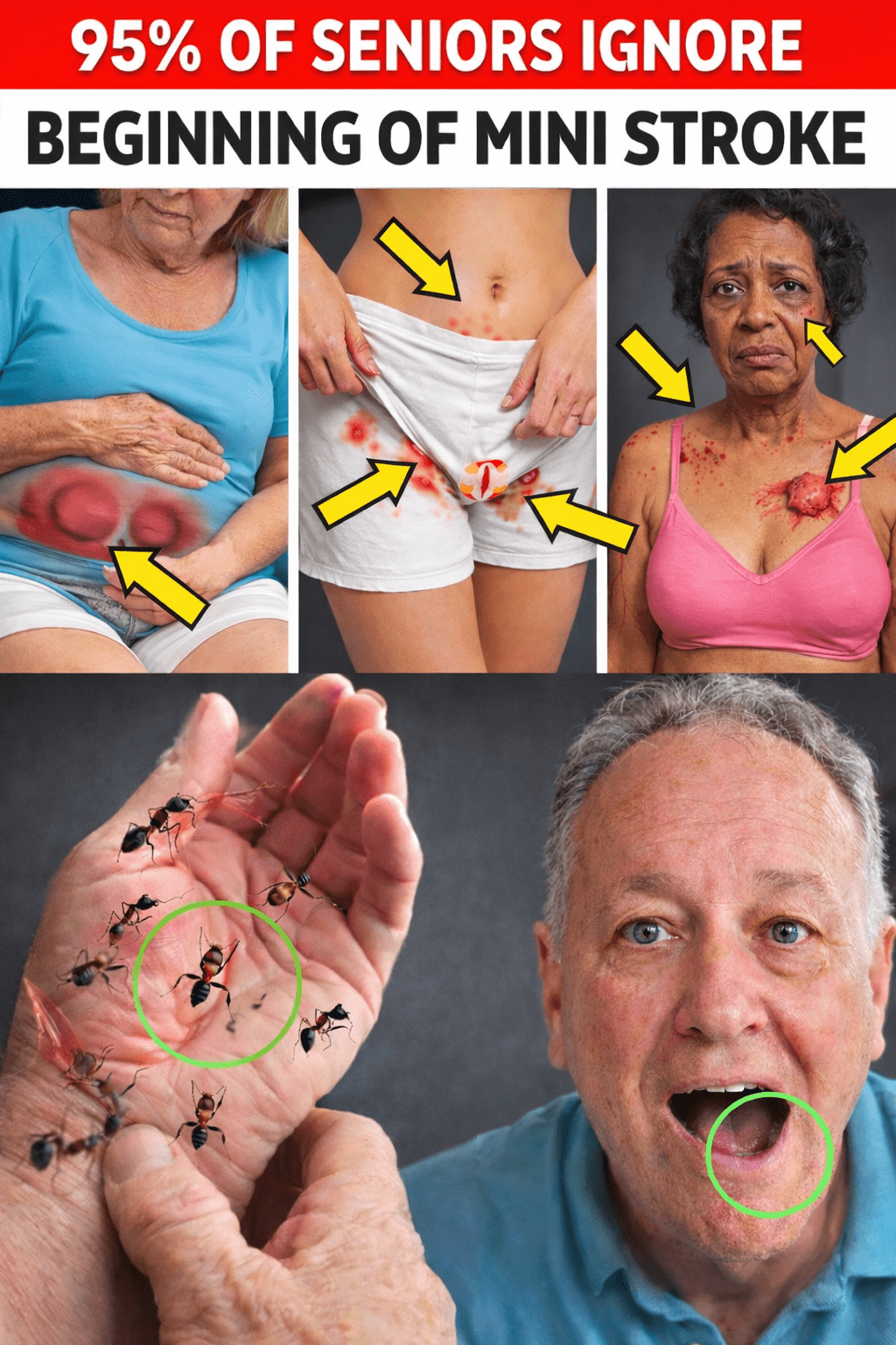 10 signes subtils d’un accident ischémique transitoire (AIT) que les personnes de plus de 60 ans négligent souvent