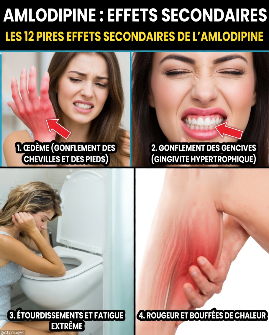 Quels sont les effets secondaires les plus courants de l’amlodipine ? 12 choses à surveiller