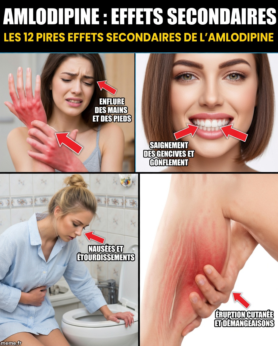 Qu’est-ce que l’amlodipine et pourquoi provoque-t-elle des effets secondaires ?