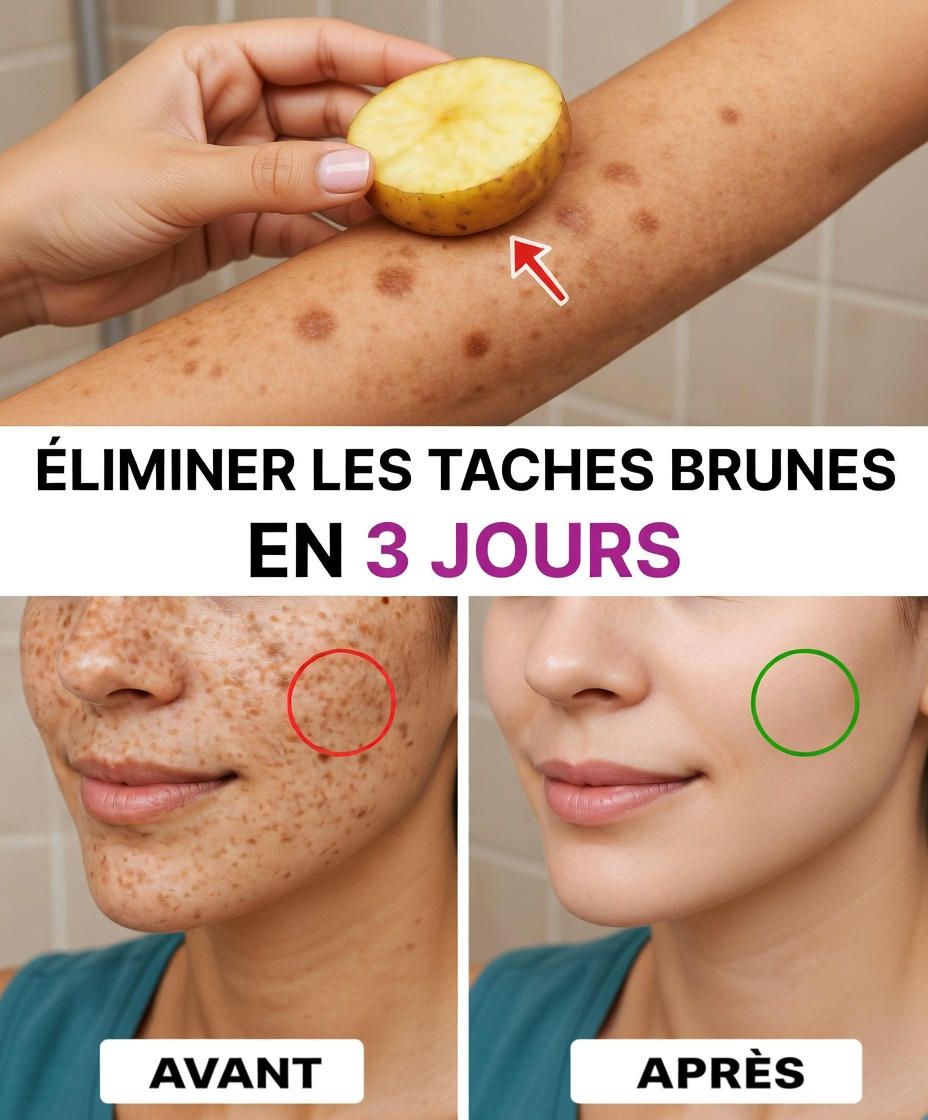 Éliminez les taches de vieillesse, le mélasma, les taches solaires, les imperfections et les signes de l’âge.