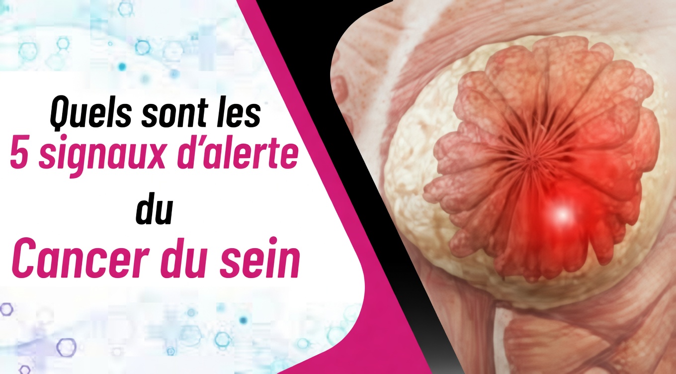 4 signes précoces du cancer du sein que toute femme devrait connaître