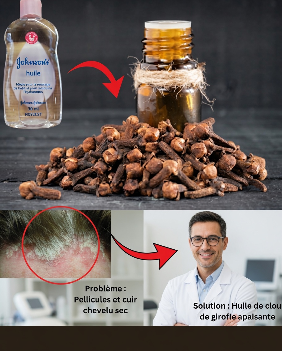 Ajoutez des clous de girofle à l’huile pour bébé et découvrez ce qui se passe