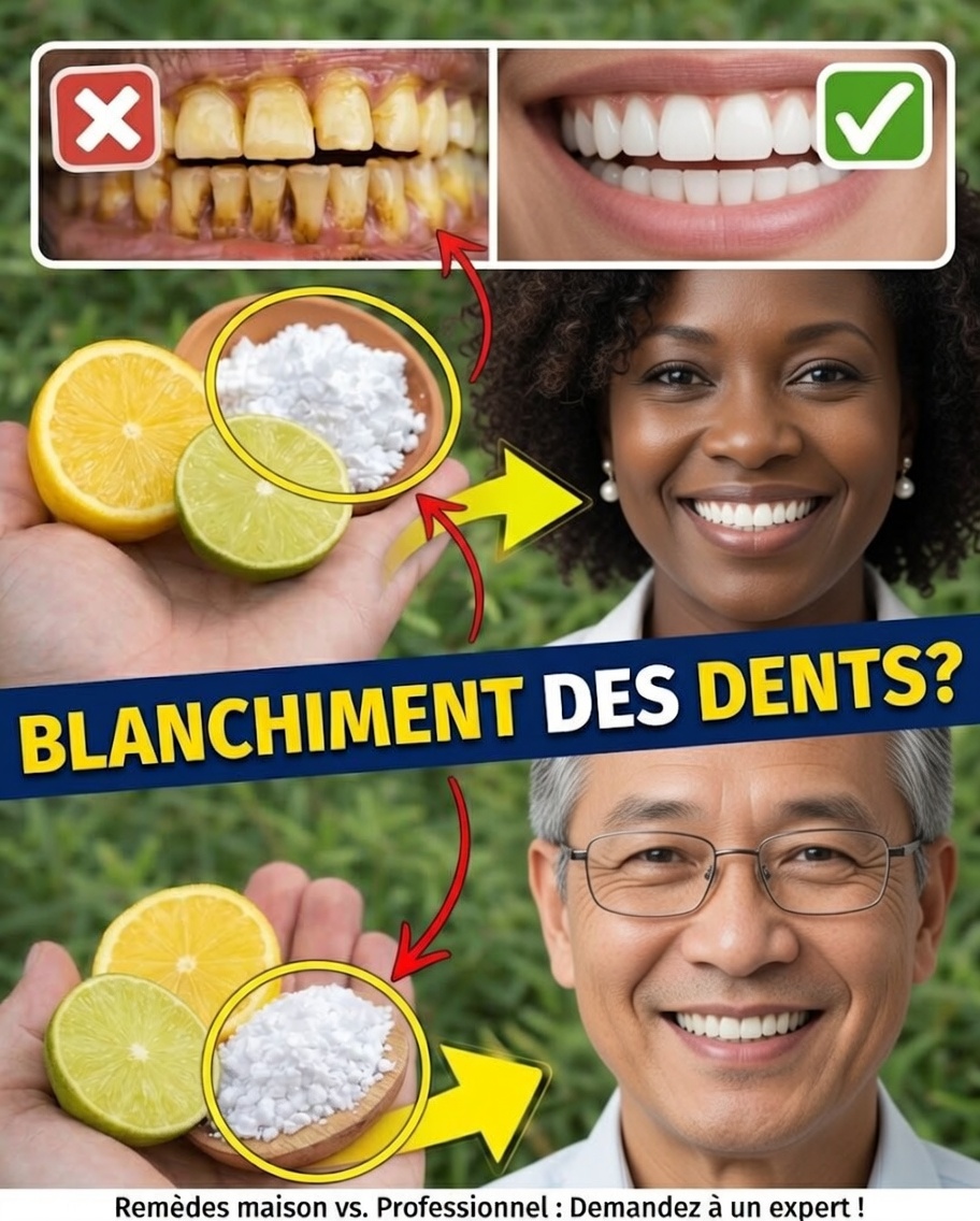 Citron et bicarbonate de soude pour un sourire plus éclatant : ce qui marche vraiment et ce qu’il faut éviter