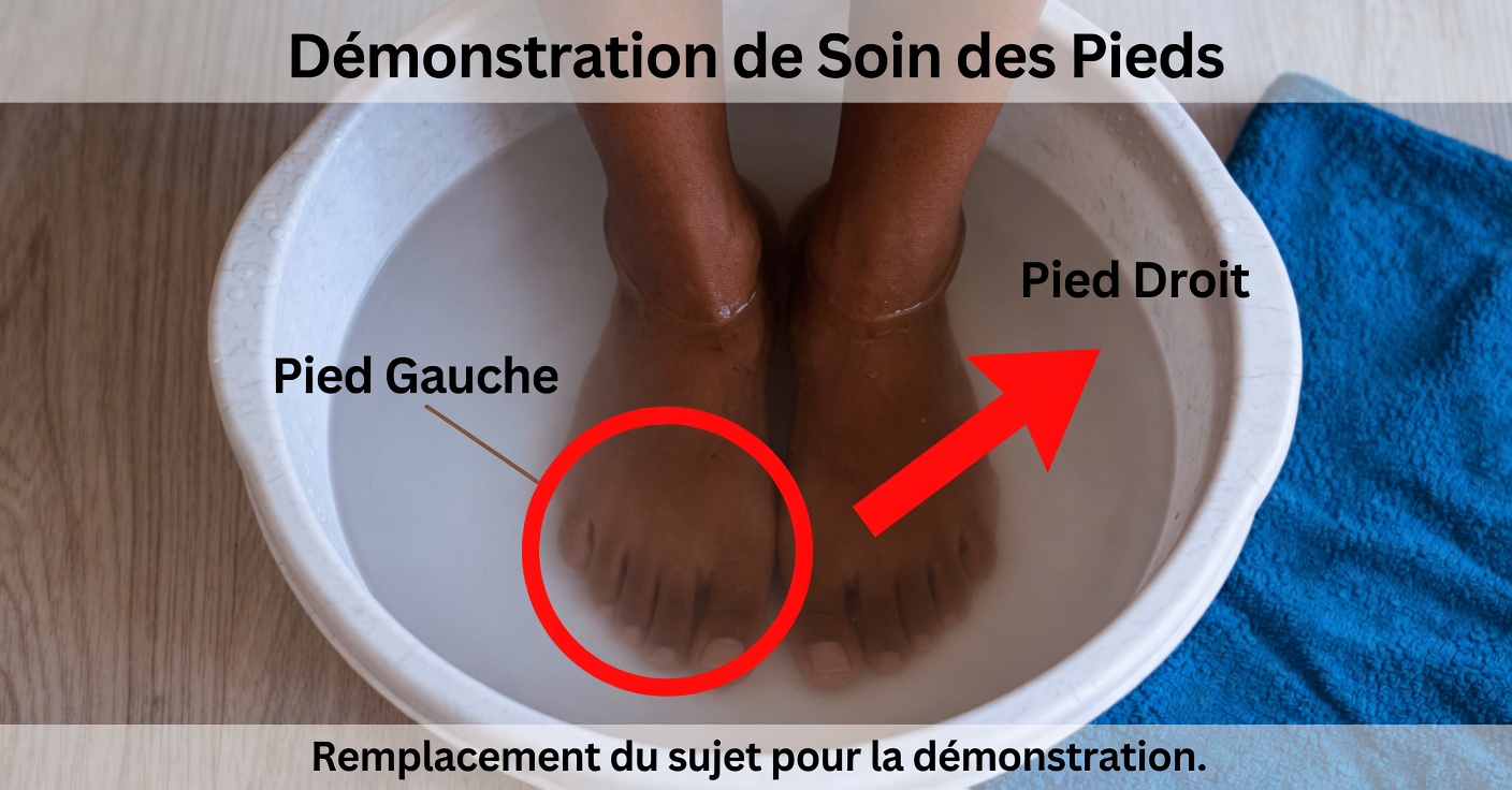 Bain de pieds au gingembre : soulagement naturel et détoxification