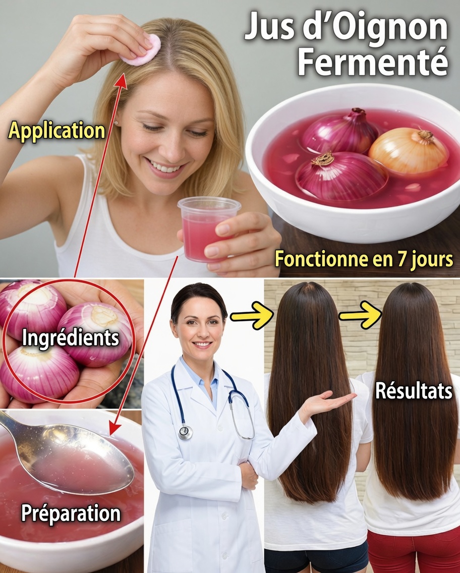 Jus d’oignon fermenté : le secret naturel pour des cheveux plus épais, plus forts et à croissance rapide