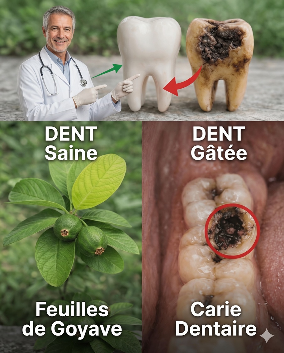 Comment éclaircir naturellement votre sourire avec des feuilles de goyave : un remède maison simple