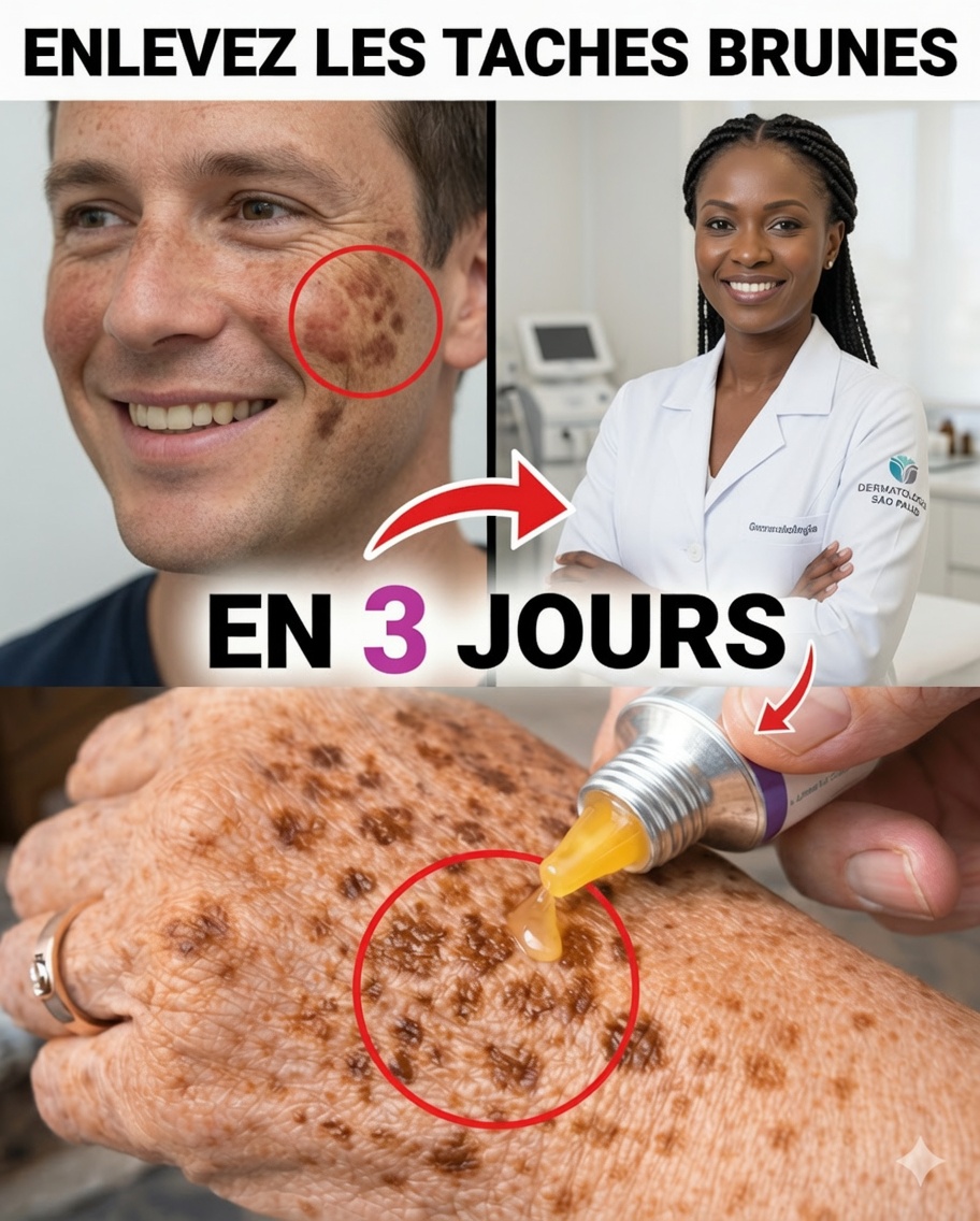 Éliminez naturellement les taches de vieillesse : masque simple à base de fécule de maïs, bicarbonate de soude et citron pour une peau plus claire et uniforme