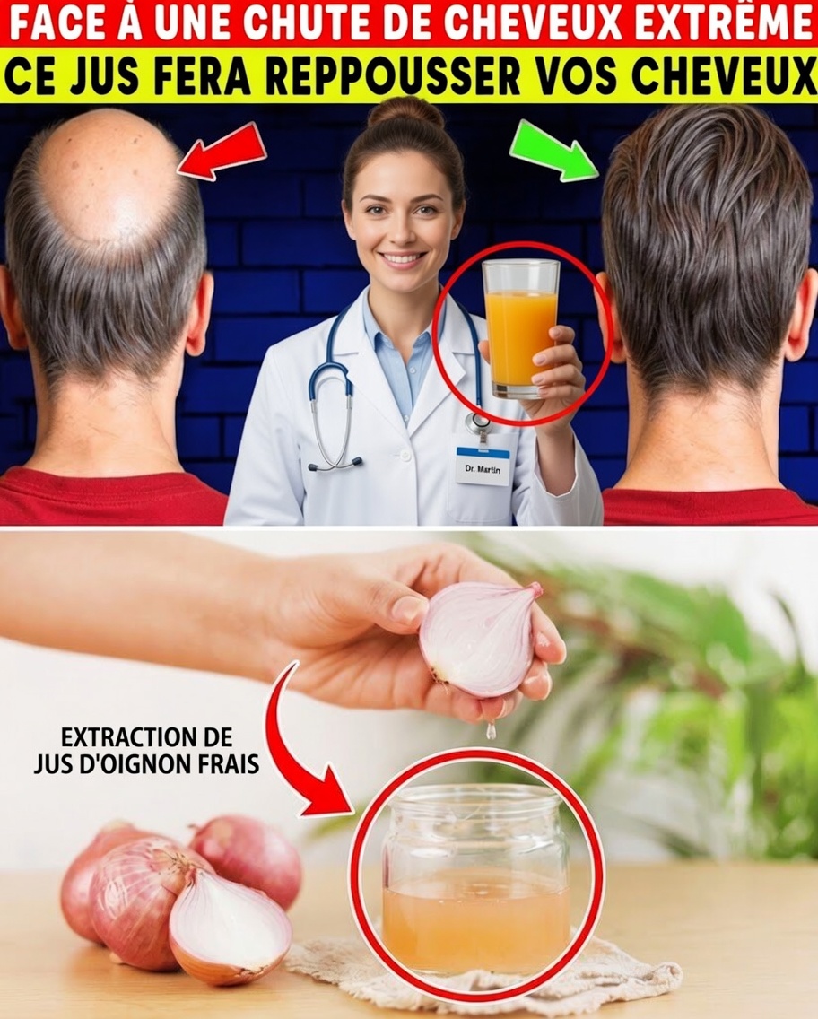Jus d’oignon pour la pousse des cheveux : 7 jours peuvent-ils vraiment transformer naturellement votre cuir chevelu ?