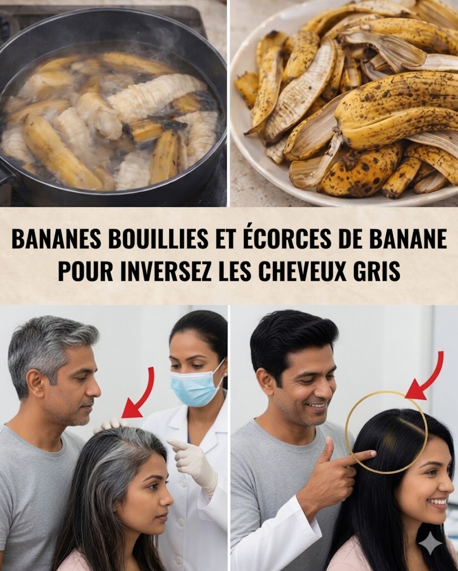 Les cheveux blancs redevenant naturellement noirs ? La vérité sur la peau de banane pour inverser les cheveux gris et stimuler la croissance capillaire
