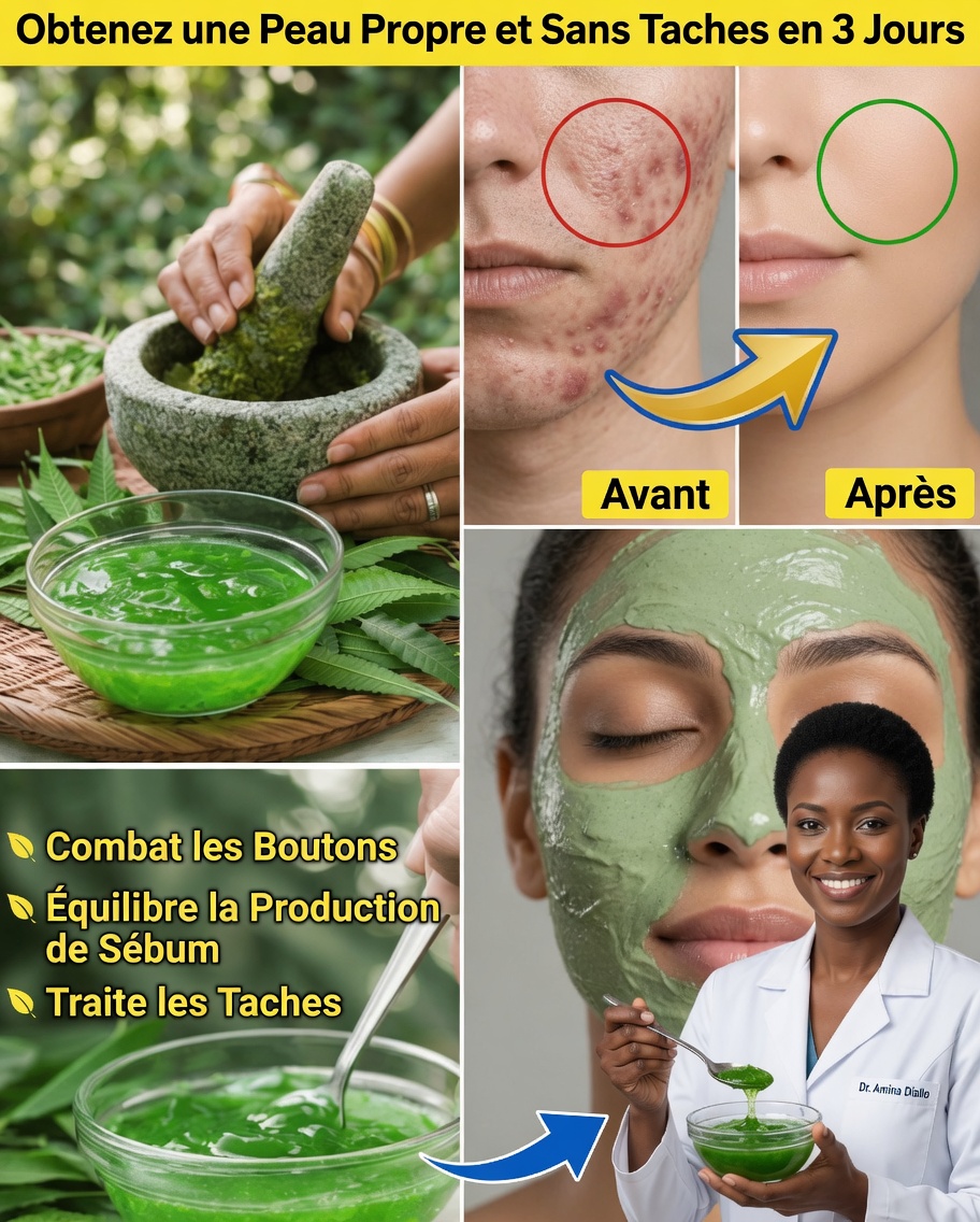 Comment faire et utiliser un gel maison de neem pour une peau plus saine à la maison