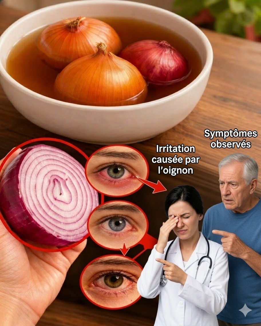 Le jus d’oignon peut-il soutenir en douceur la santé des yeux ? Un remède naturel qui vaut la peine d’être exploré