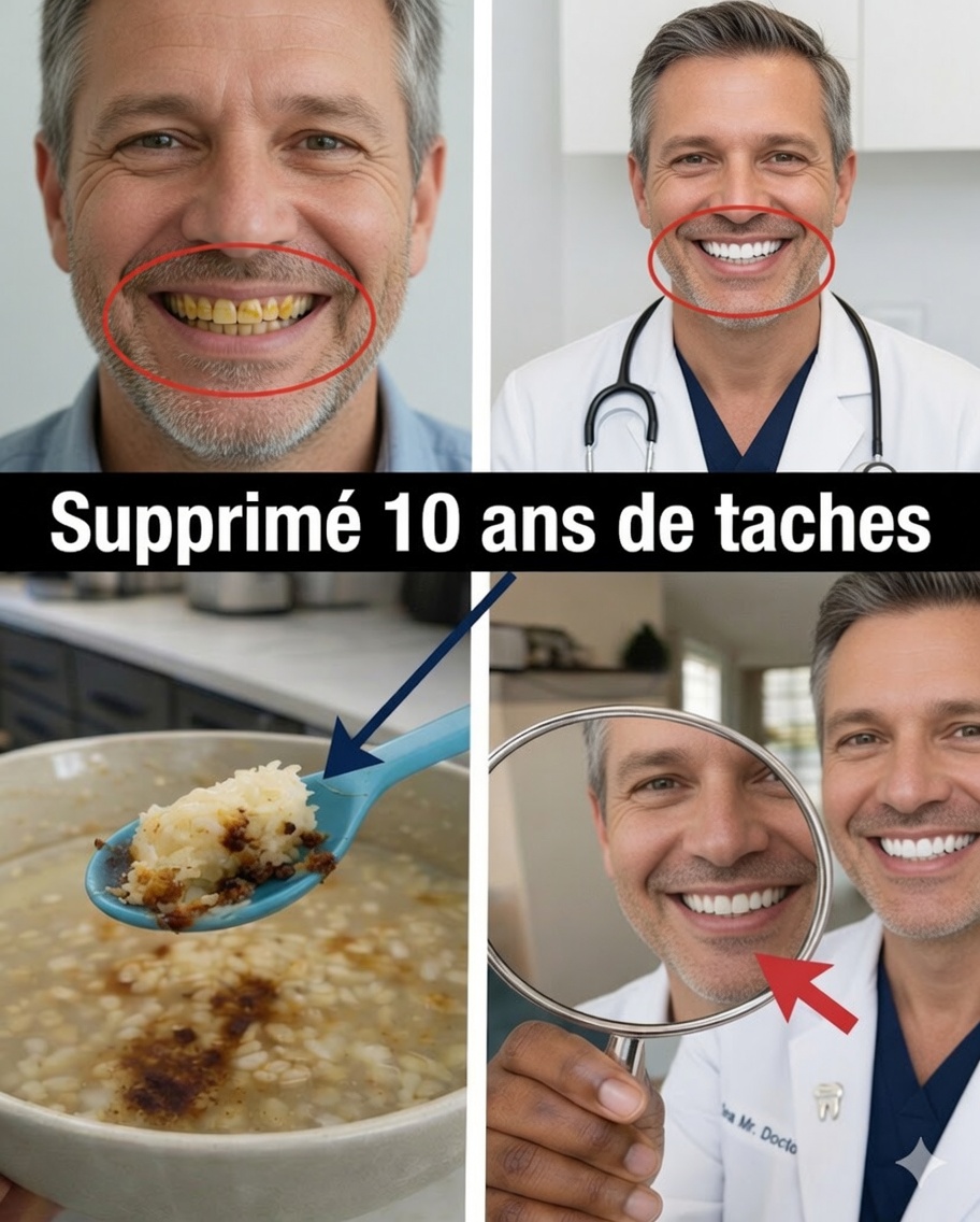En 2 minutes, retirez 10 ans de taches sur les dents ? La vérité qui va vous surprendre