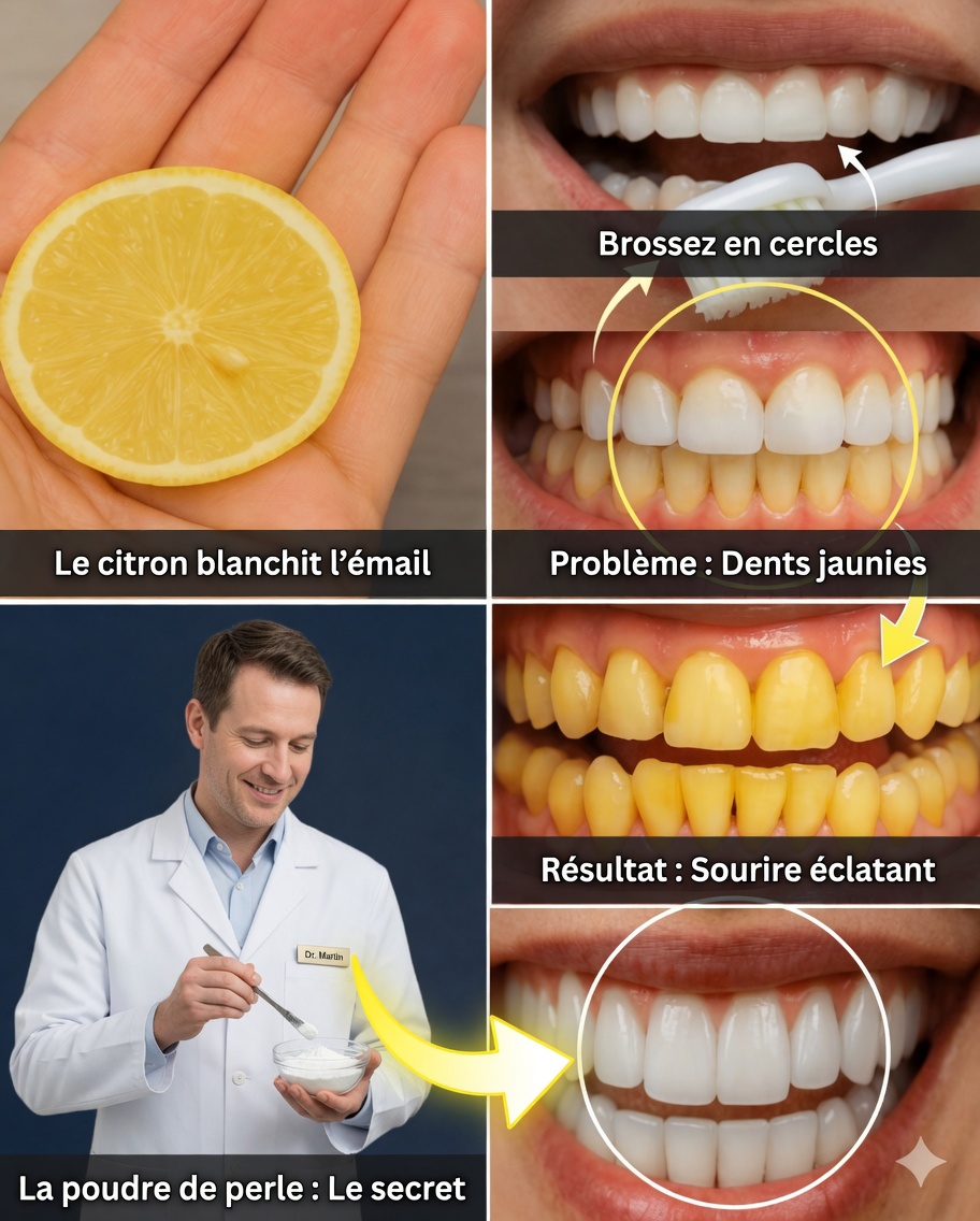 Débloquez un sourire plus blanc avec du citron et du bicarbonate de soude
