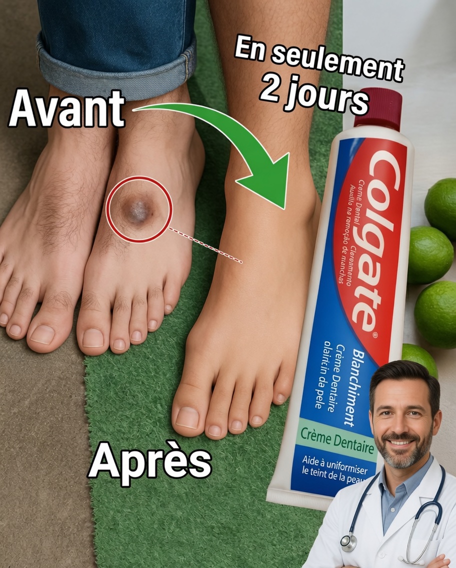 Le Secret Surprenant de Colgate pour des Pieds Plus Doux