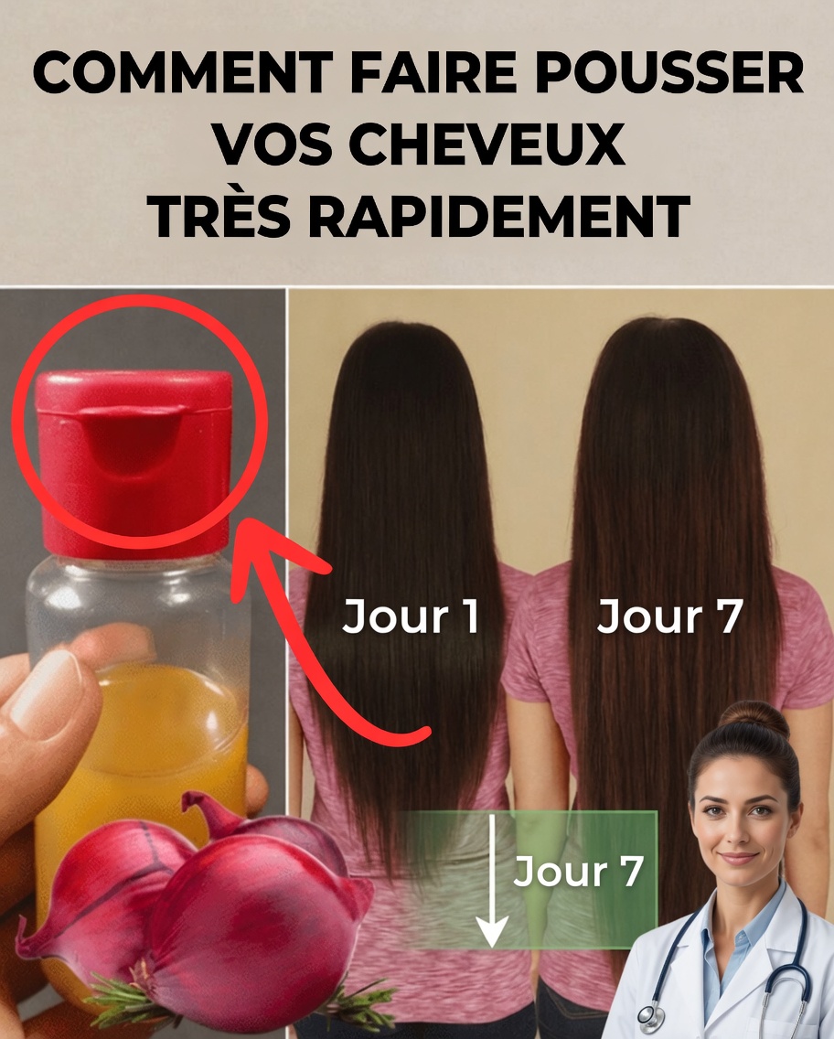 Comment faire de l’huile d’oignon pour une pousse rapide des cheveux et stopper la chute