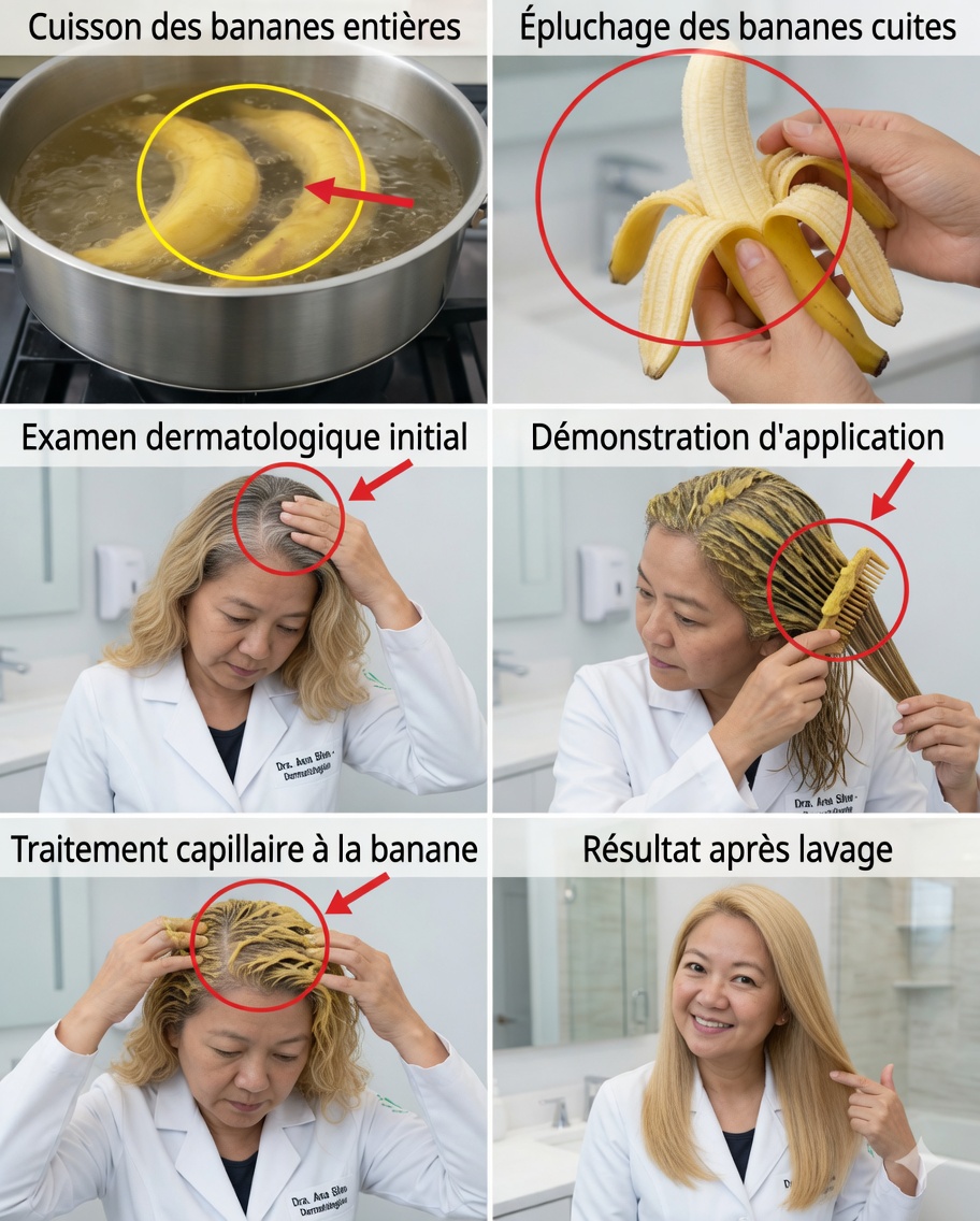 Le secret de la peau de banane : peut-elle aider à foncer les cheveux gris et à stimuler la pousse des cheveux ?