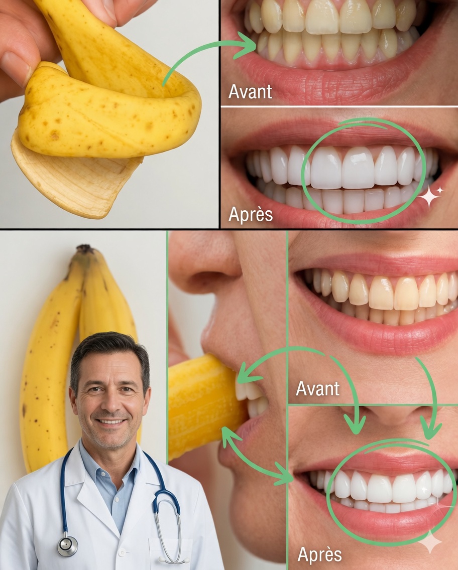 Illuminez votre sourire en seulement 2 minutes avec une peau de banane
