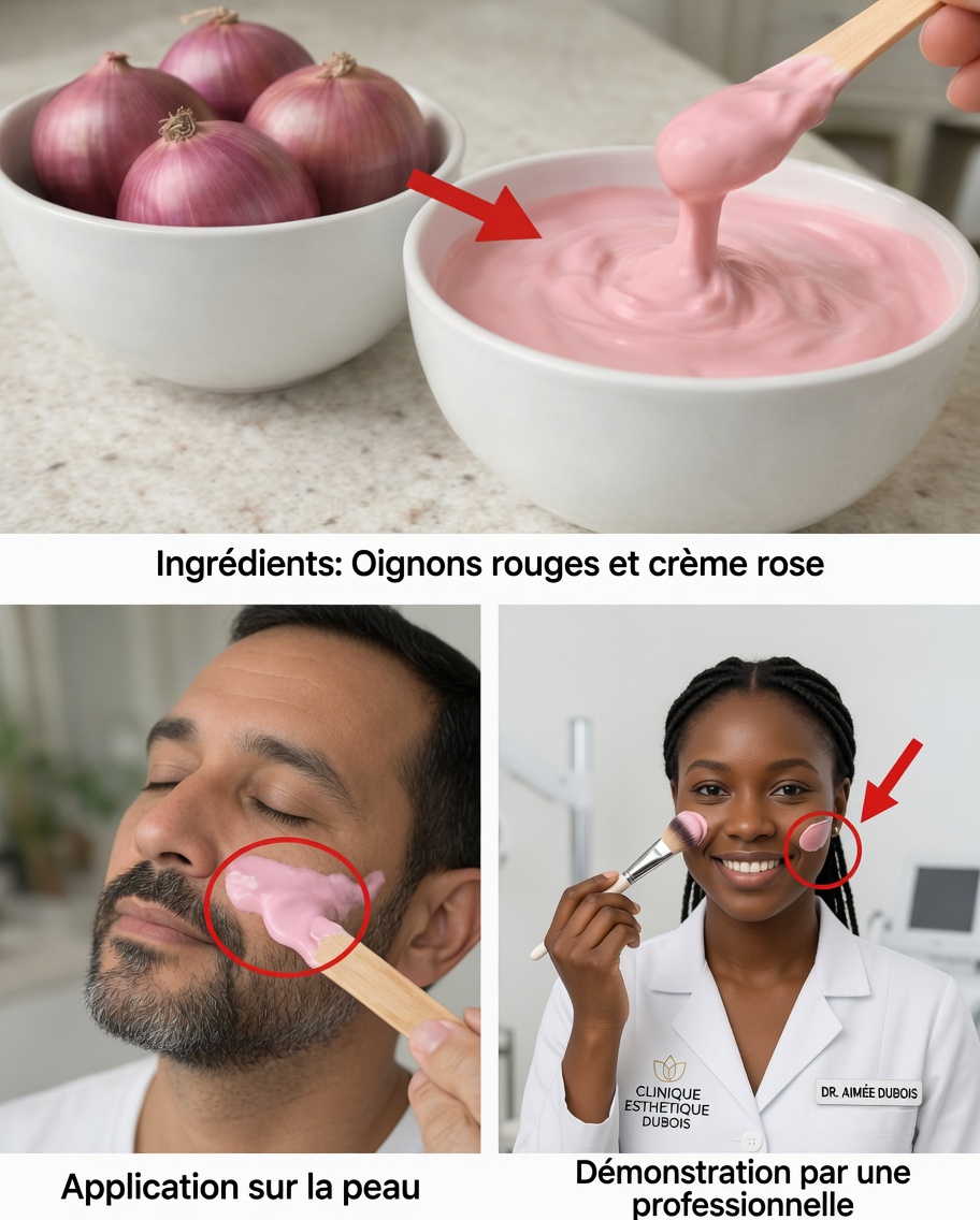 Le pouvoir surprenant des oignons roses pour une peau plus lisse et plus jeune