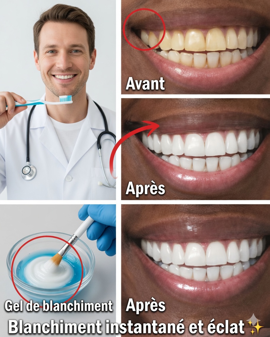 Comment éclaircir naturellement les dents jaunies à la maison : le puissant secret de la banane, du gingembre et du citron qui fait sensation