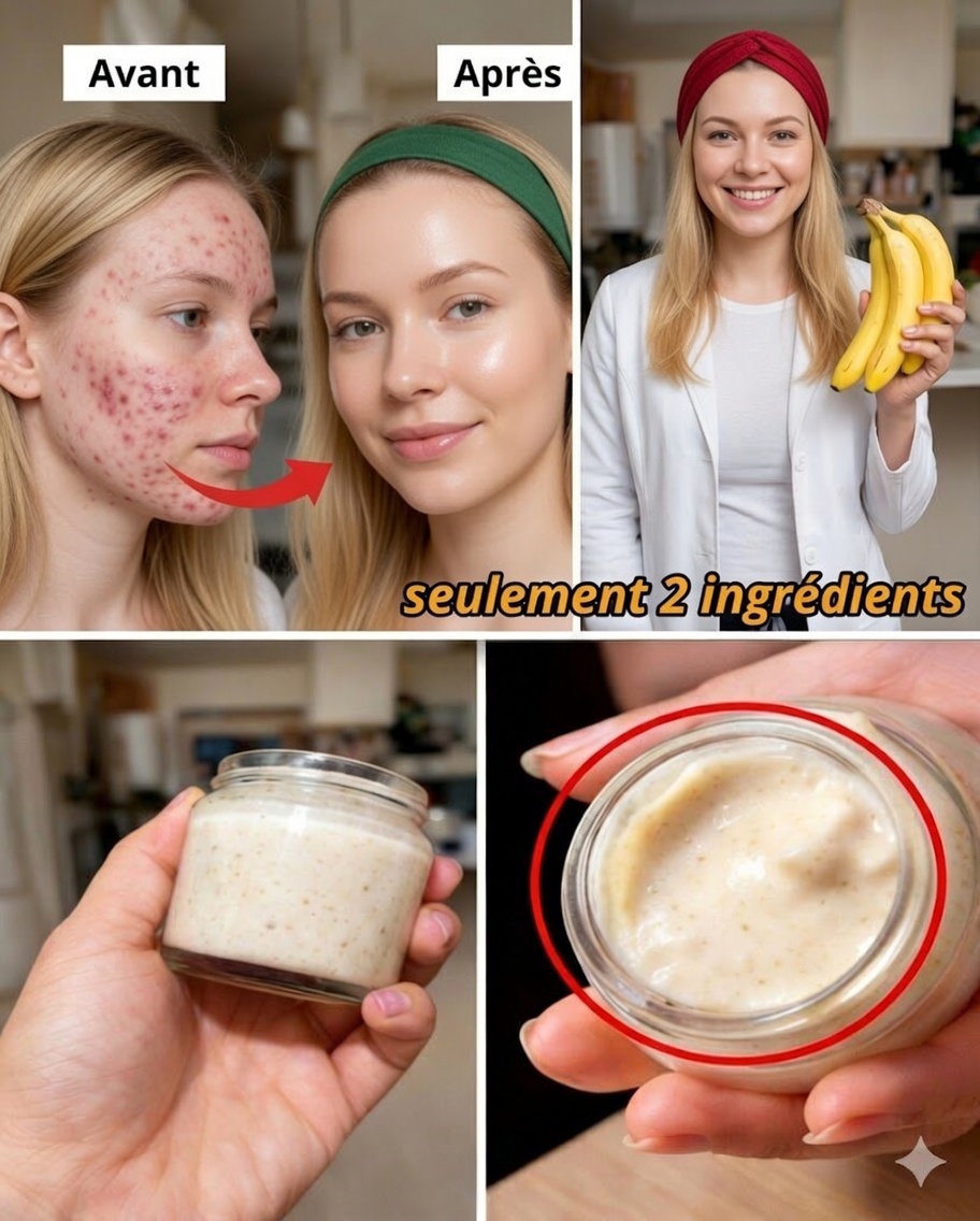 7 Façons naturelles d’atténuer les ridules et d’illuminer la peau avec une peau de banane