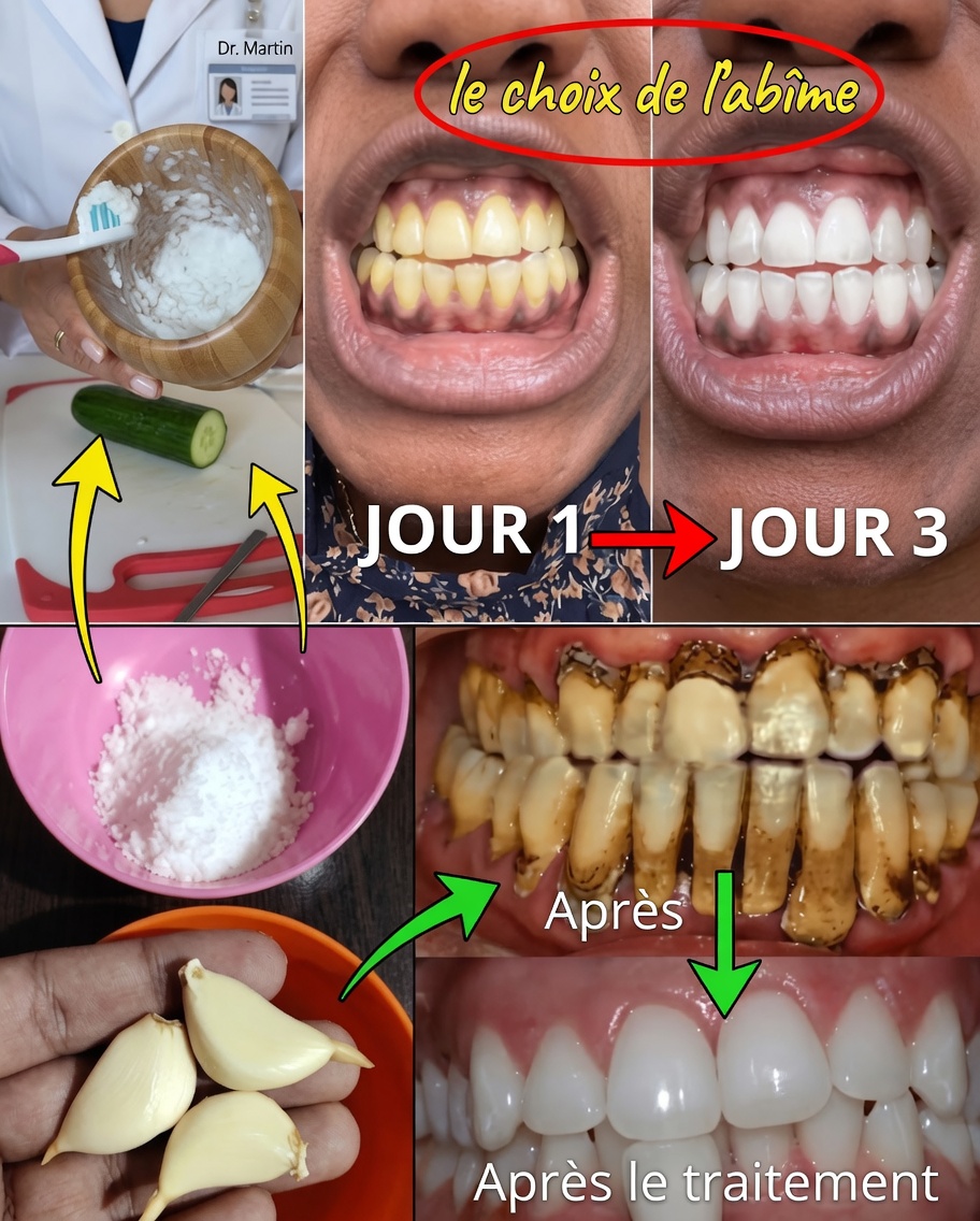 Souriez comme jamais : découvrez les secrets d’un sourire éblouissant à la maison