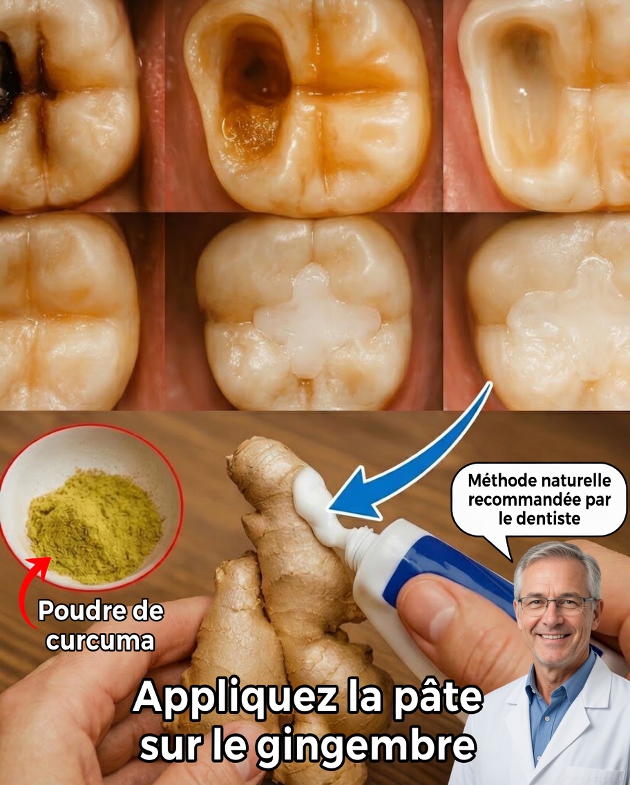 Fatigué des caries ? Découvrez comment renforcer naturellement vos dents