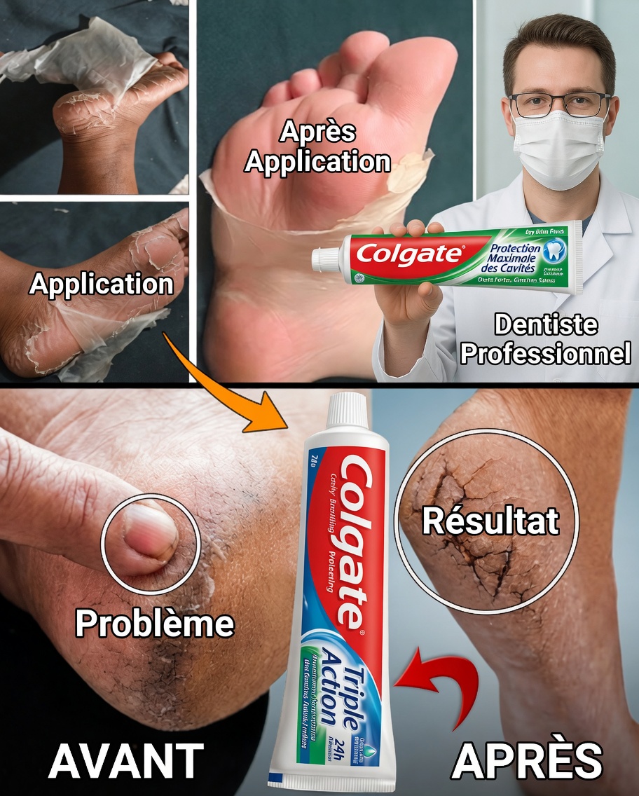 Secret de soin des pieds Colgate : une astuce simple pour des pieds plus doux et en meilleure santé
