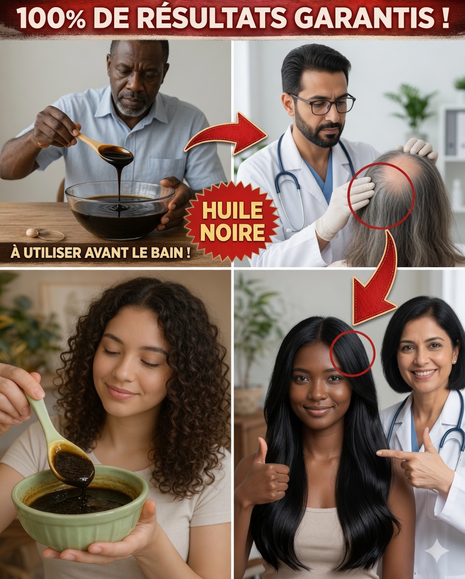 Cheveux blancs à noirs naturellement : remèdes maison sûrs qui peuvent foncer les cheveux gris