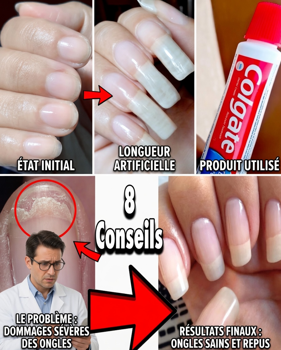Ravivez naturellement les ongles fragiles : le puissant secret de l’ail pour des ongles plus forts et en meilleure santé