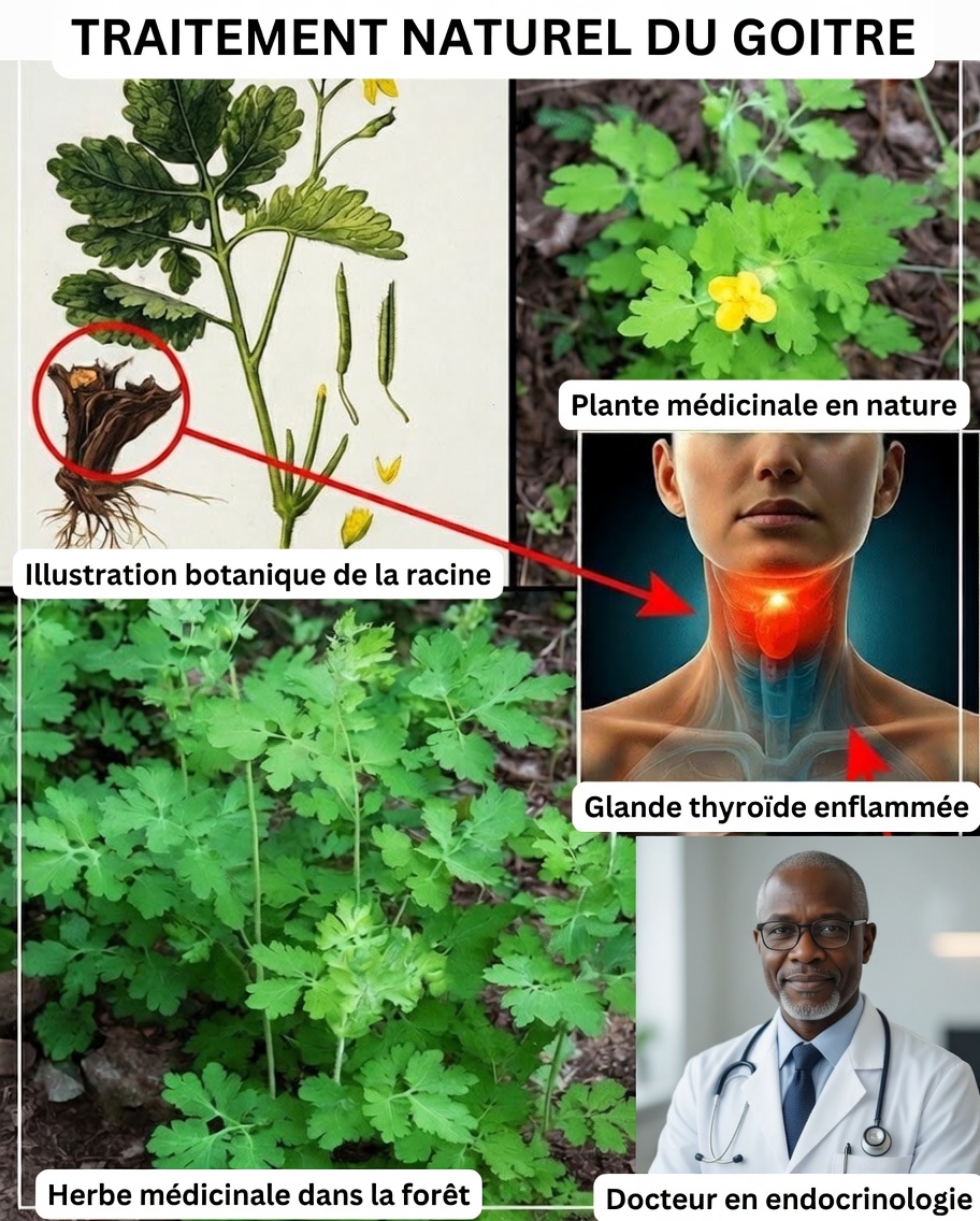La sève de chélidoine : le remède naturel caché qui pousse tout autour de nous