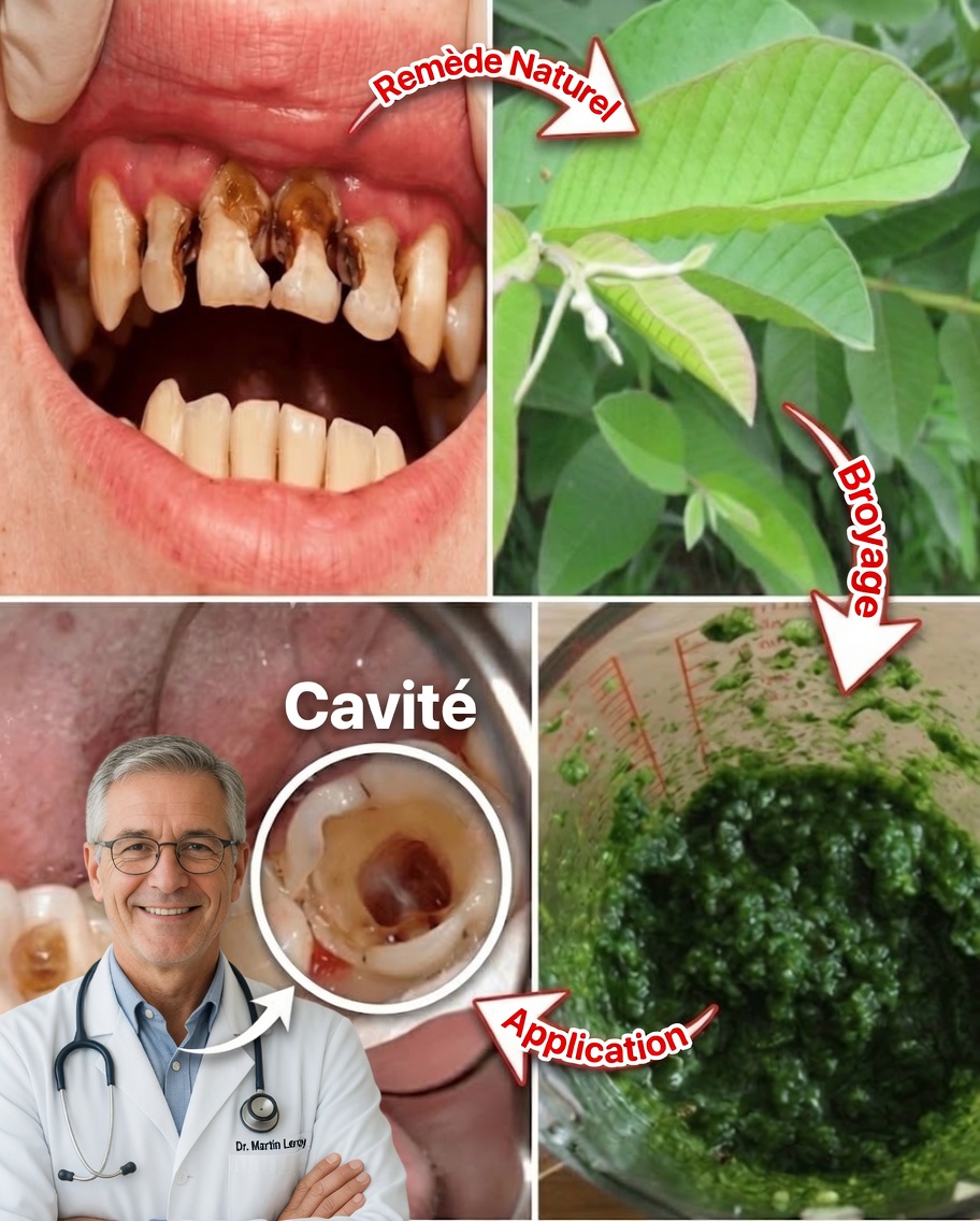 Feuilles de goyave pour un sourire éclatant : le secret naturel de soins bucco-dentaires transmis par une grand-mère de 70 ans