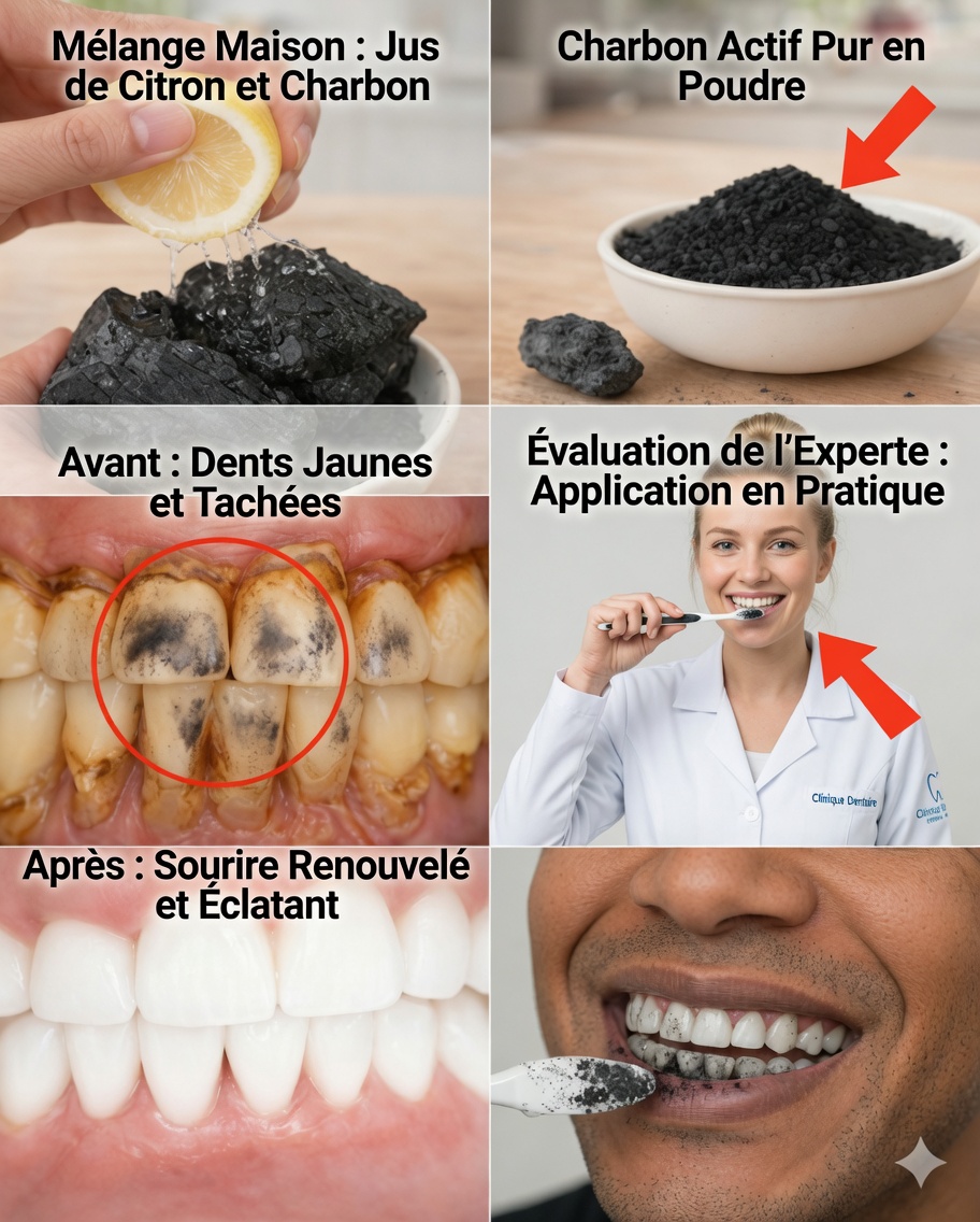 Comment éclaircir ses dents en toute sécurité : la vérité sur le charbon et le citron (et ce qui fonctionne vraiment)