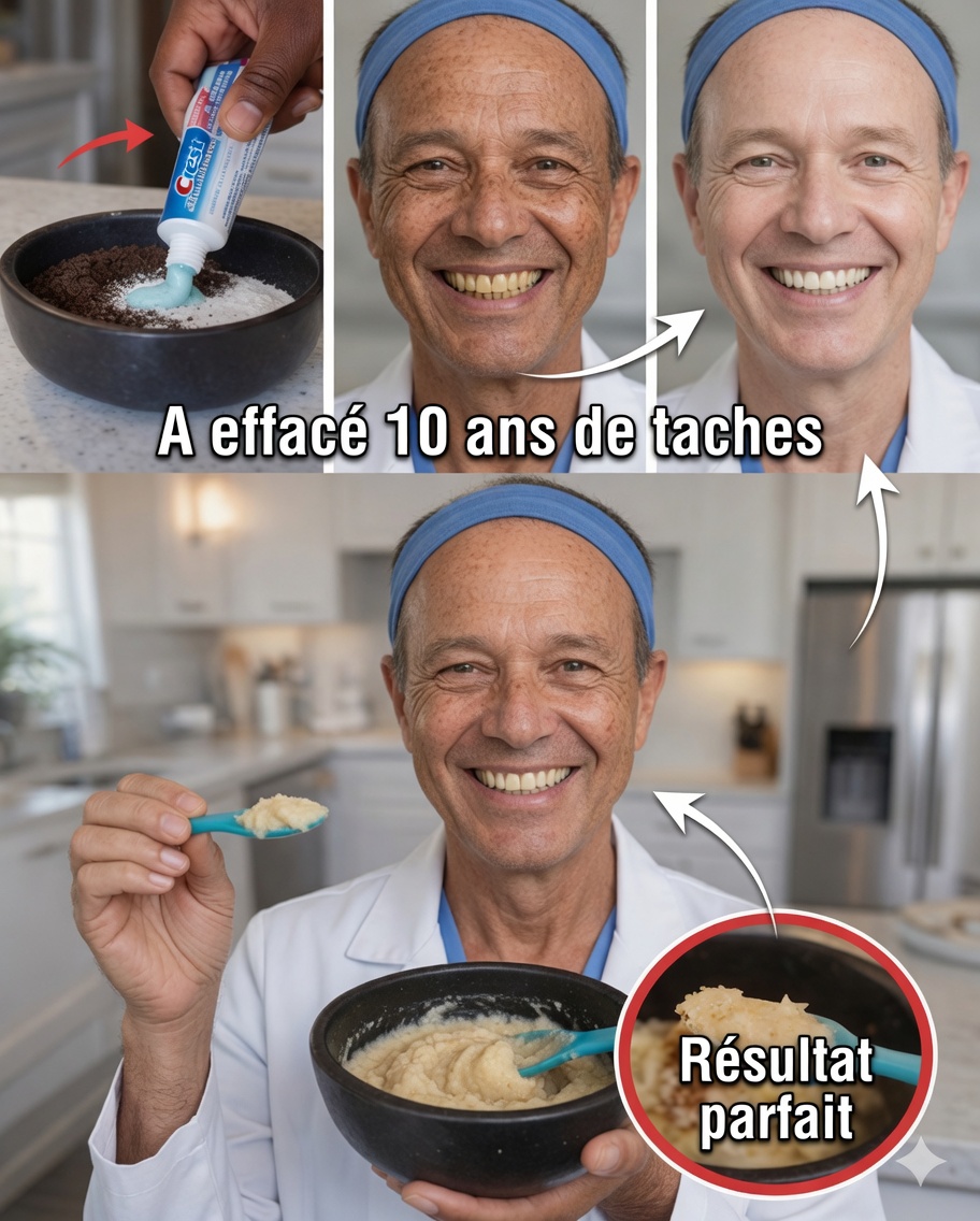 Éliminez jusqu’à 10 ans de taches dentaires en seulement 2 minutes – Le blanchisseur naturel qui attire l’attention
